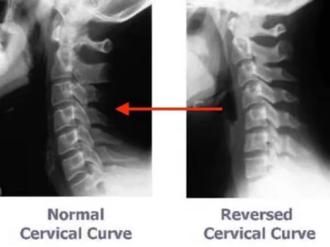 Treatment | CCI Foundation