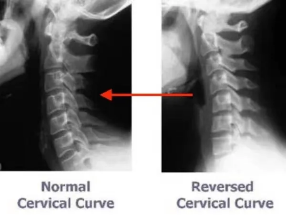 Treatment | CCI Foundation