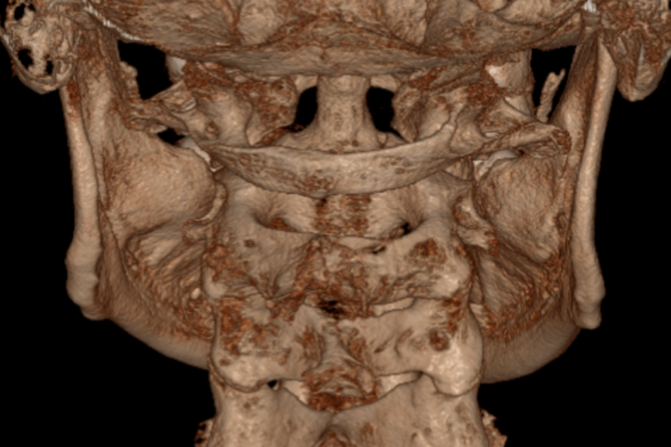 Diagnosis | CCI Foundation